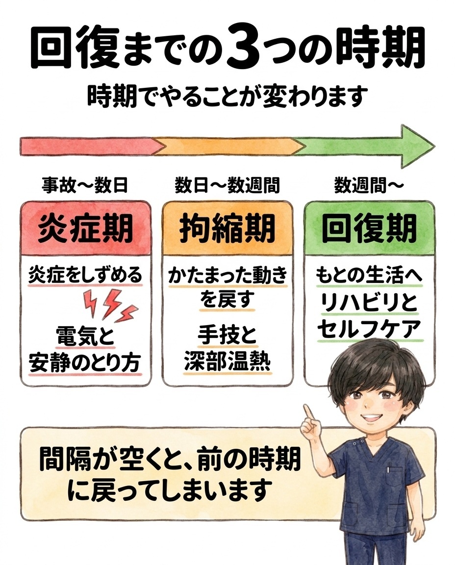 交通事故の回復は炎症期・拘縮期・回復期の3つの時期に分かれ、時期ごとに施術の内容が変わる。炎症期は電気と安静のとり方、拘縮期は手技と深部温熱、回復期はリハビリとセルフケア