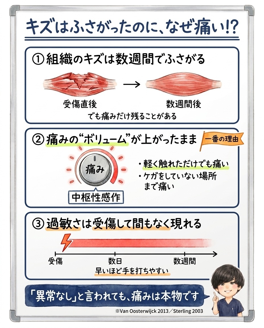 組織のキズがふさがっても痛みが残る理由。痛みのボリュームが上がったままになる中枢性感作と、過敏さが受傷後まもなく現れることを示した図解