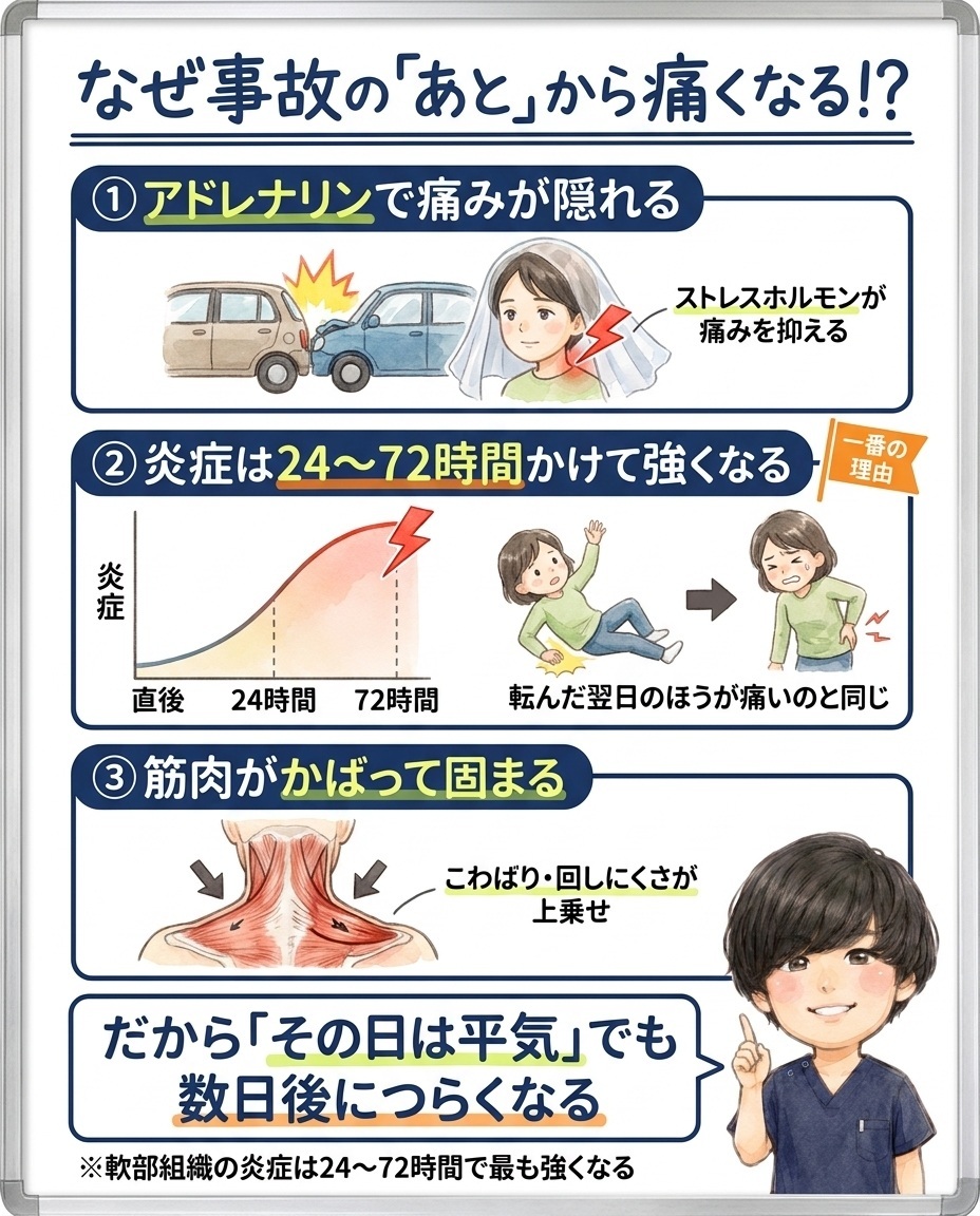 交通事故のあとから痛くなる3つの理由。アドレナリンで痛みが隠れる、炎症が24〜72時間かけて強くなる、筋肉がかばって固まることを示した図解